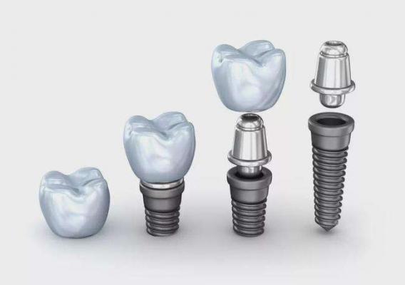 牙科種植系統Dental Implant System